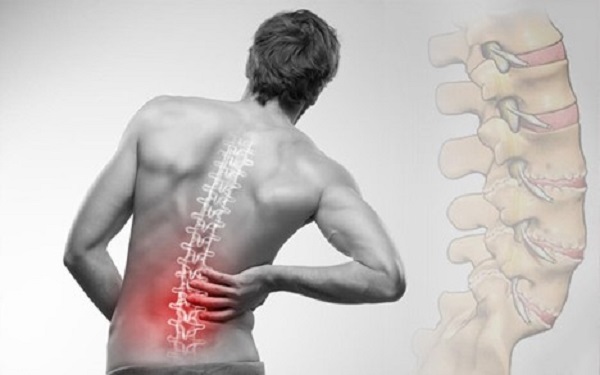 Châm cứu: Phương pháp tuyệt vời điều trị đau lưng