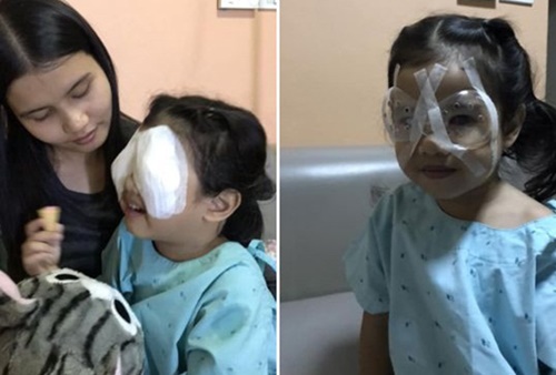 Chiều con, cho xem điện thoại hàng giờ: Bé gái 4 tuổi suýt mù cả hai mắt