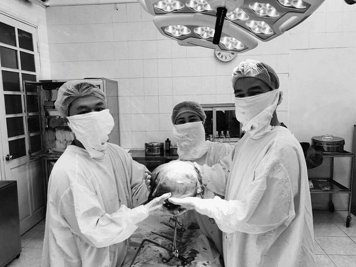 HOT: Bệnh viện Phụ sản HN mổ u xơ tử cung to bằng thai nhi 9 tháng